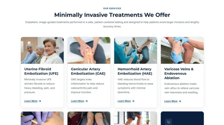 Treatment cards for uterine fibroid, genicular artery and hemorrhoid artery embolization and varicose vein ablation on the VidaVascular website